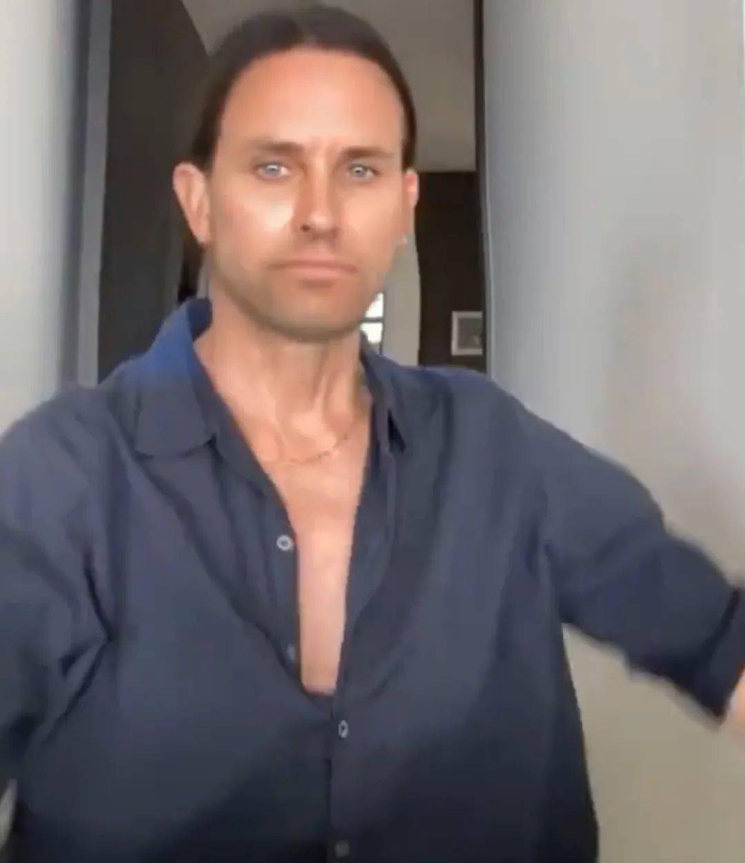 all|《老友记》最美艳女主角,自嘲整容上瘾“假脸怪”:她明明有一个最有趣的灵魂