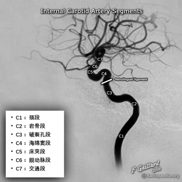 腦血管系統影像解剖學3d模式呈現