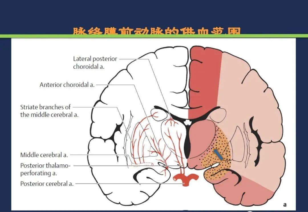 从梗死部位推测责任血管脑血管解剖