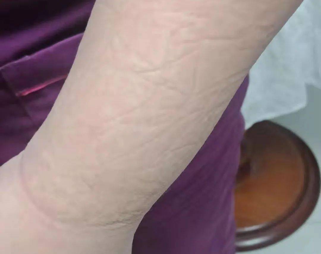 一道道勒痕泡白的双手是他们的专属勋章被汗水浸透的衣服样本接收