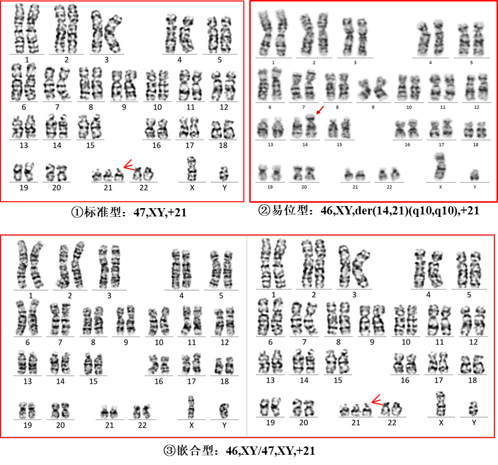 核型46xy图片