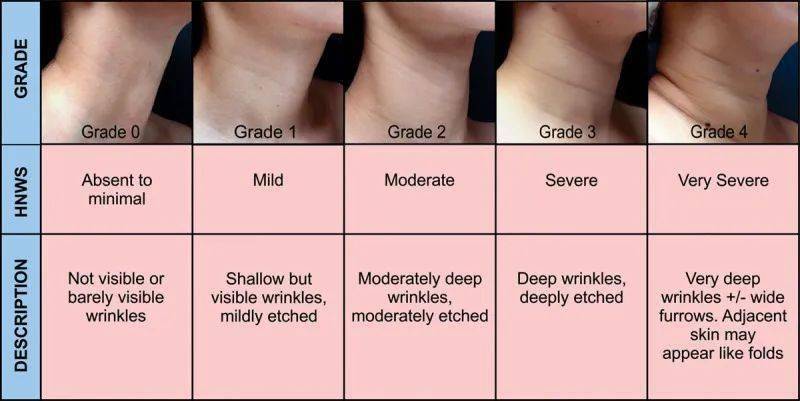 我们首先来回顾一下颈纹的分级:以前也聊过颈纹的问题,但我还是发现