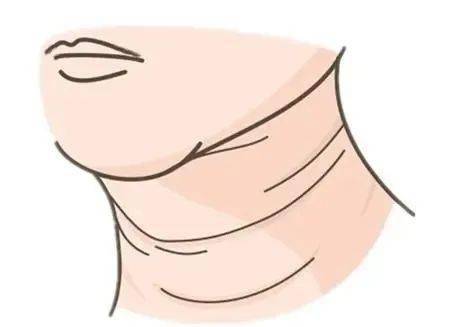 4招科学去颈纹,不用挨针也有效果!_颈部_皱纹_皮肤