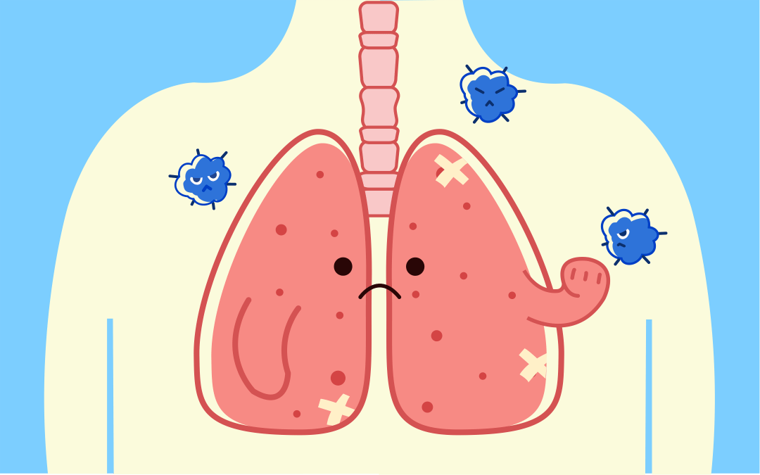 结核病是结核分支杆菌侵入人体引起的一种慢性传染病,可在身体各个