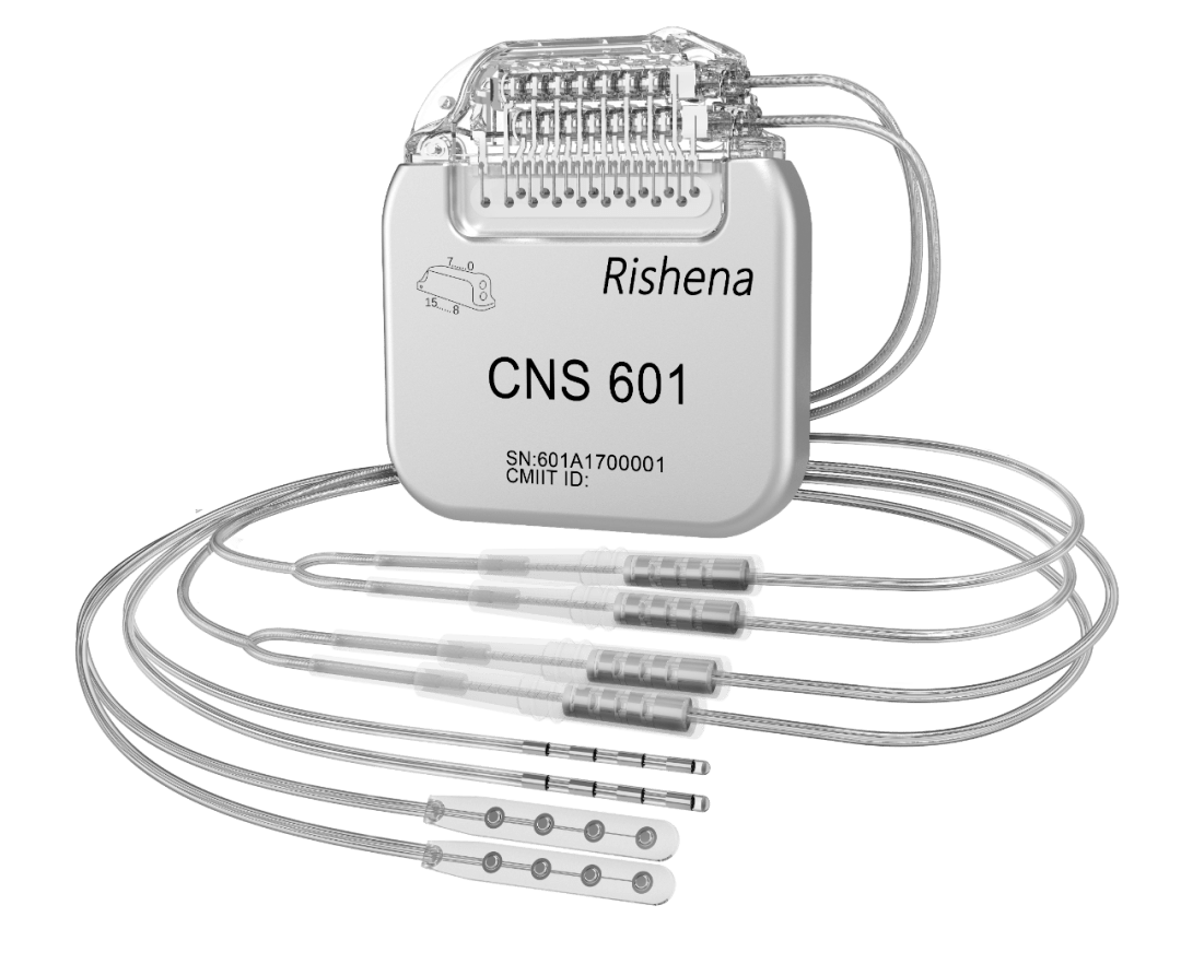 重磅国内首创闭环神经刺激器系统治疗帕金森病在宣武医院功能神外开展