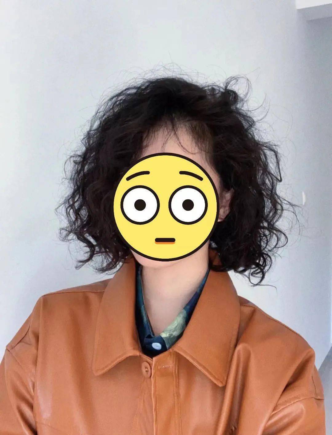 颧骨你明明才20出头，为什么就这么显老？