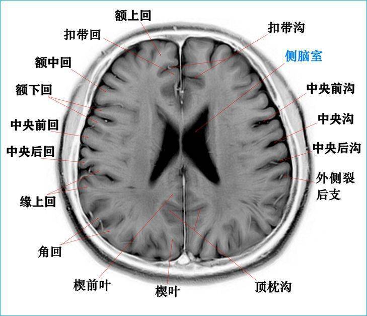 收藏高清顱腦斷層解剖圖譜