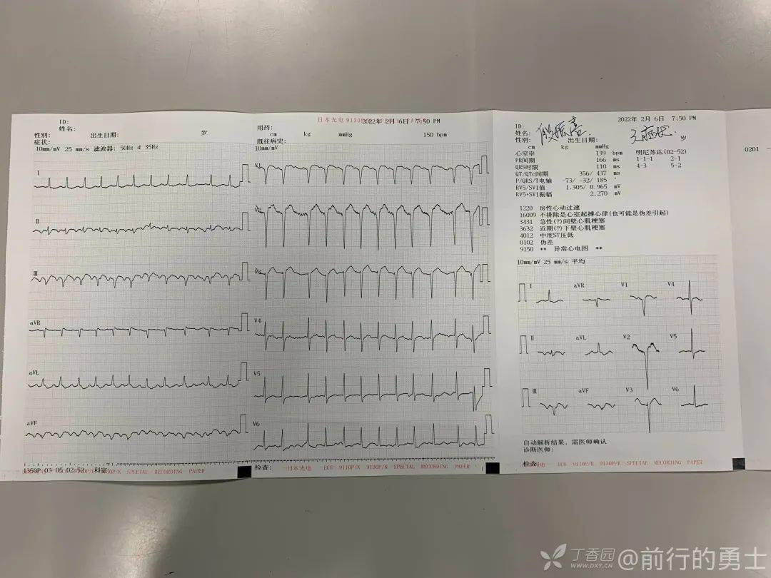 入院心电图检查