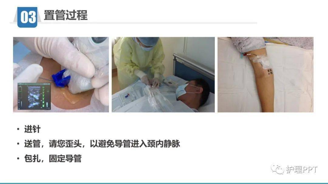pptpicc置管健康教育