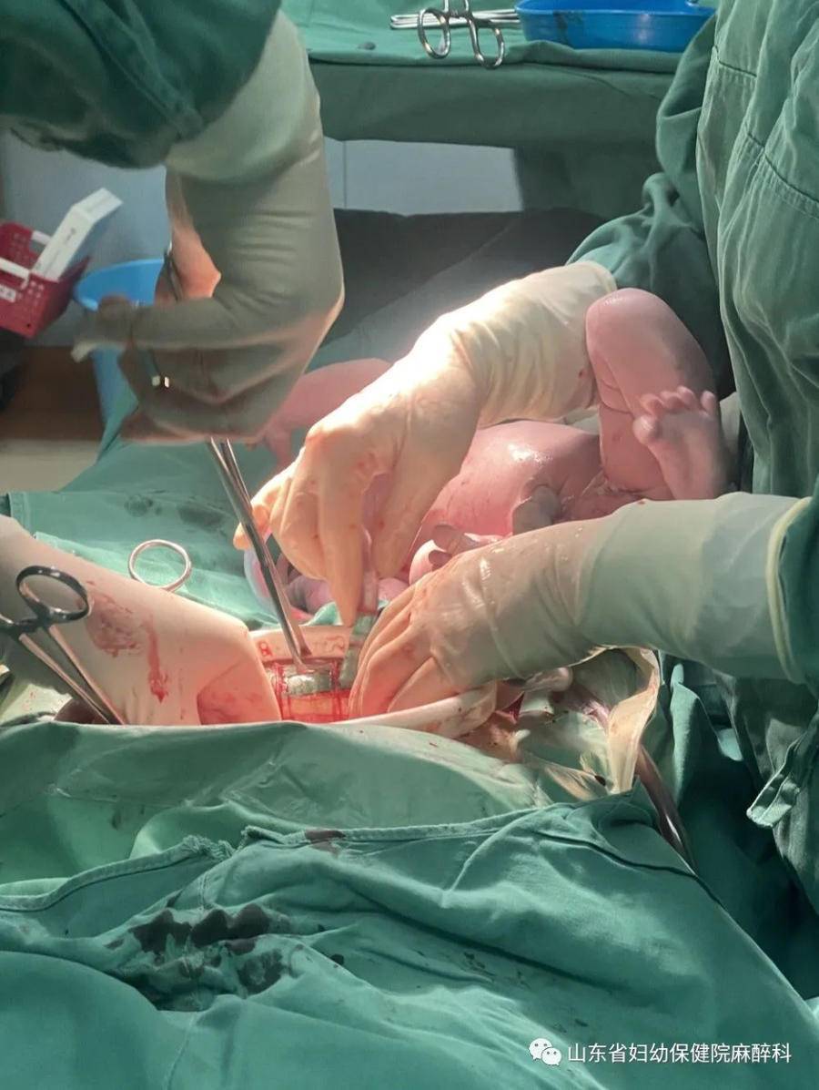 准妈妈们需要了解的剖宫产手术中的各种“不舒服”