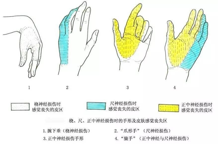 正中神经支配的区域图图片