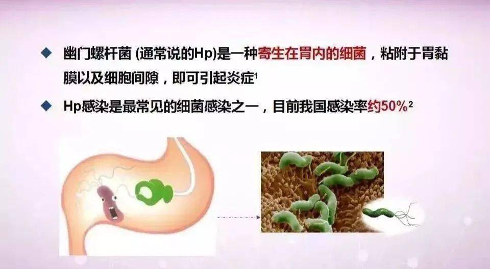 幽门螺旋杆菌(简称hp)是存在于胃及十二指肠球部的一种螺旋状细菌,它