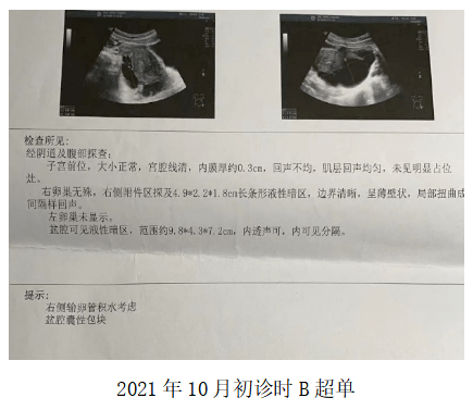 盆腔炎B超图片图片