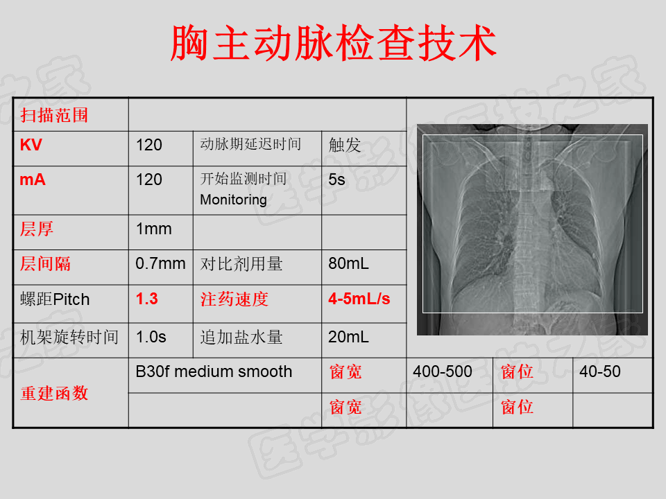 ct各部位扫描范围图图片