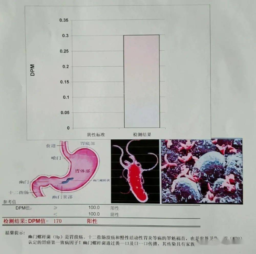 幽门螺杆菌呼气试验有没有假阳性数值越大就越严重吗