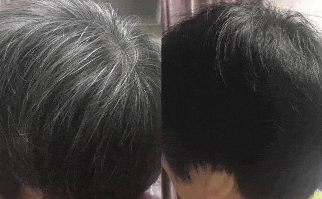 有白发不要着急染洗发水换成它一周2次洗一次黑一次白发自然变黑发