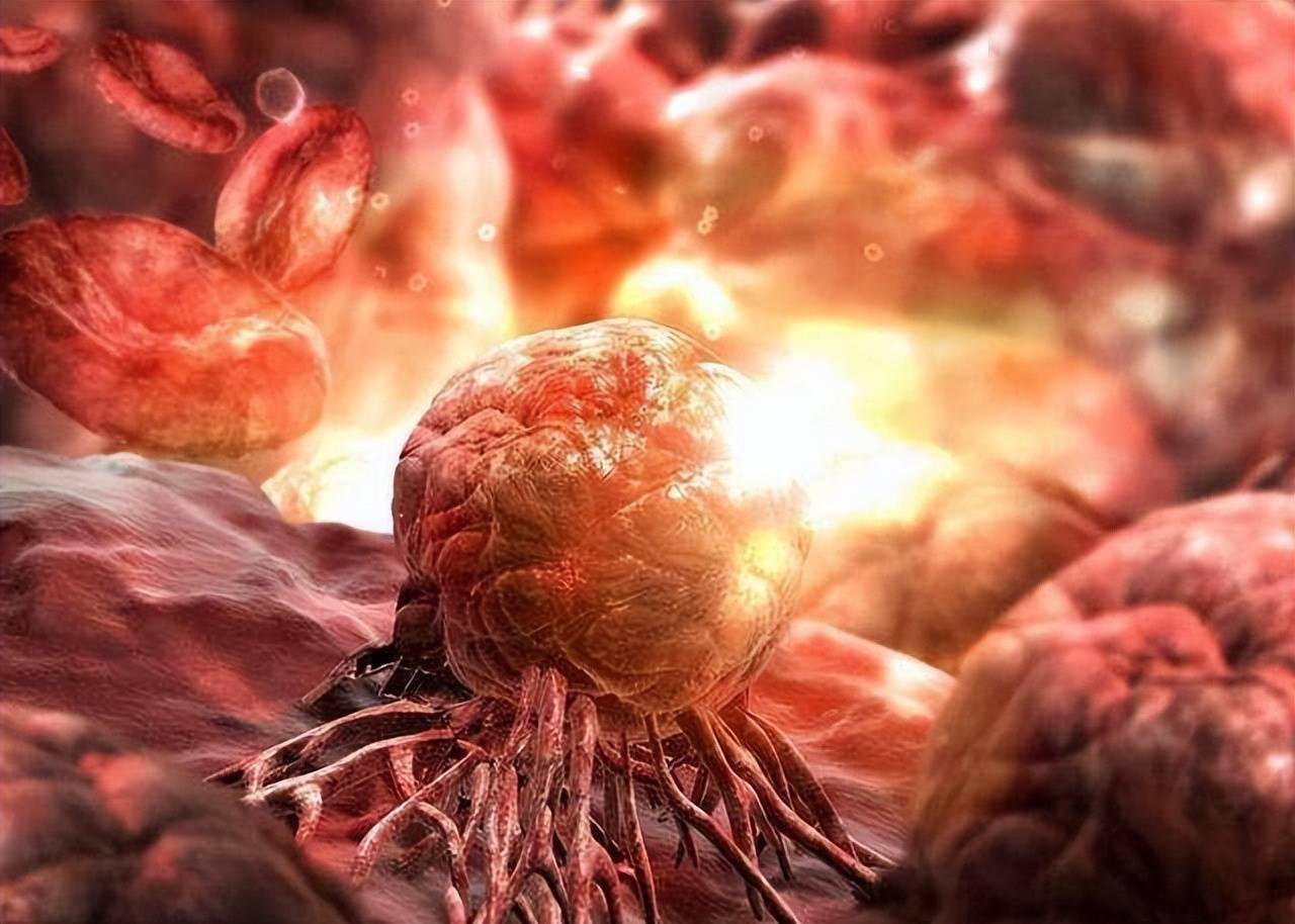 什么习惯是癌症的温床医生5点习惯不改或会滋养坏细胞