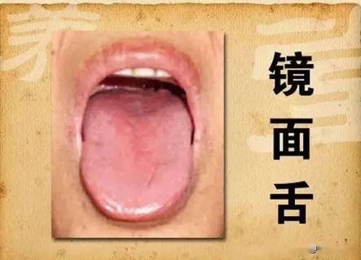 什么叫镜面舌