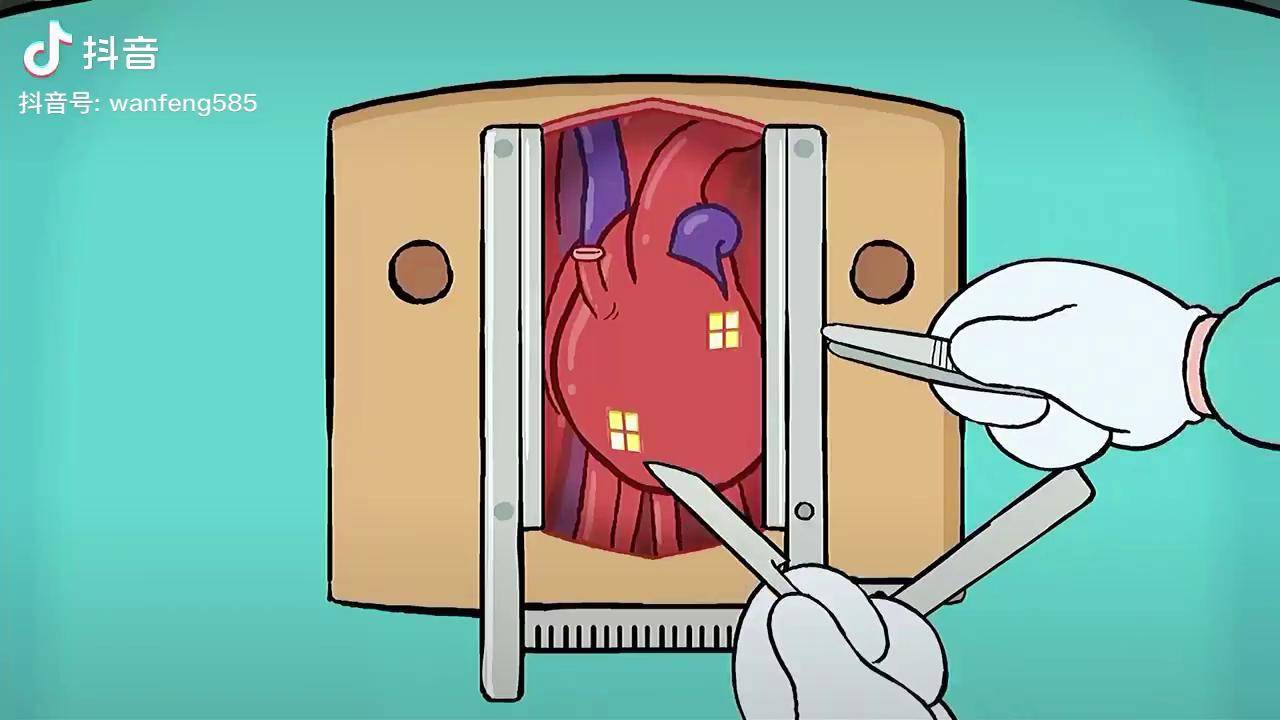 医生手术时发现病人心脏里面住了一户人家动画短片解说了不得的心脏