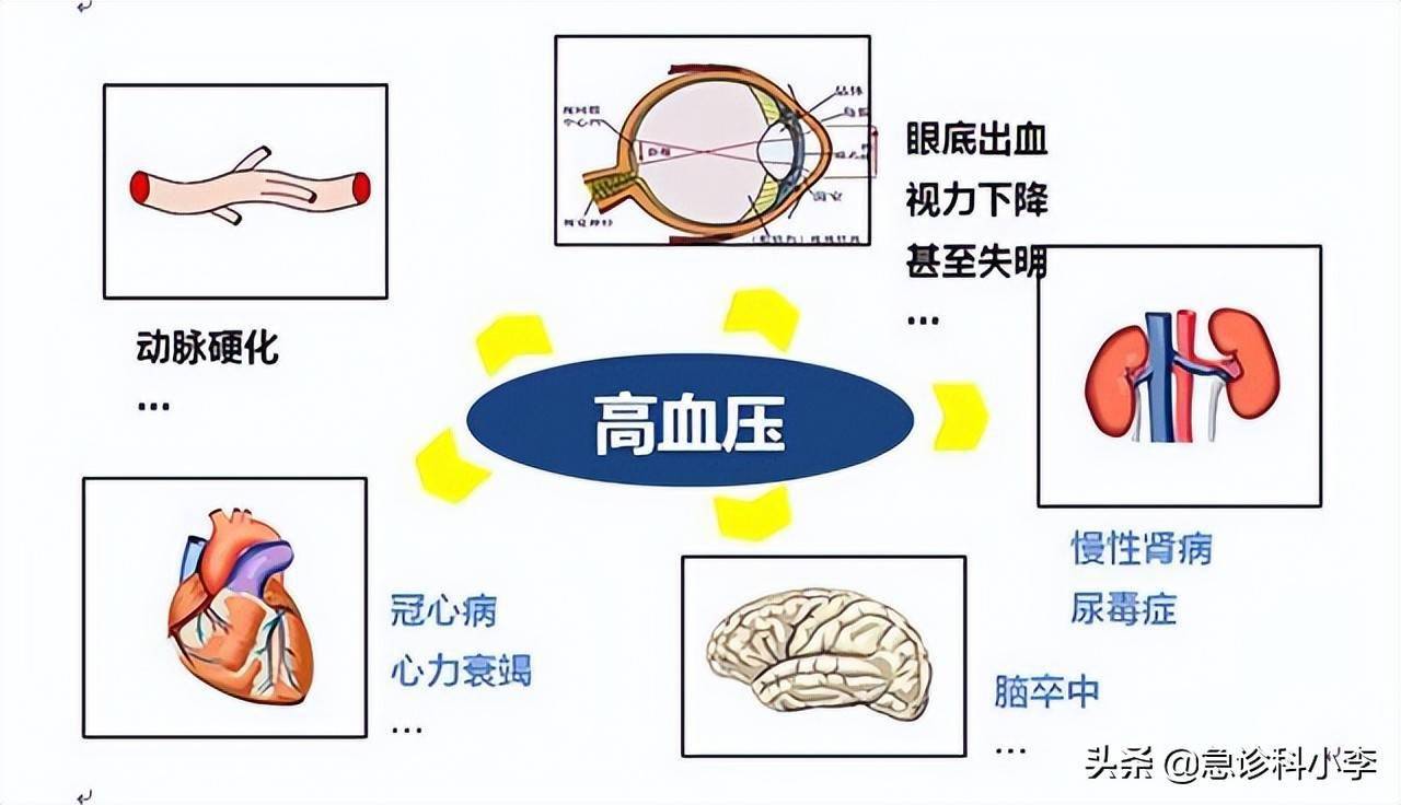 几块钱一瓶的维生素b2却是高血压的克星可惜知道得太晚了