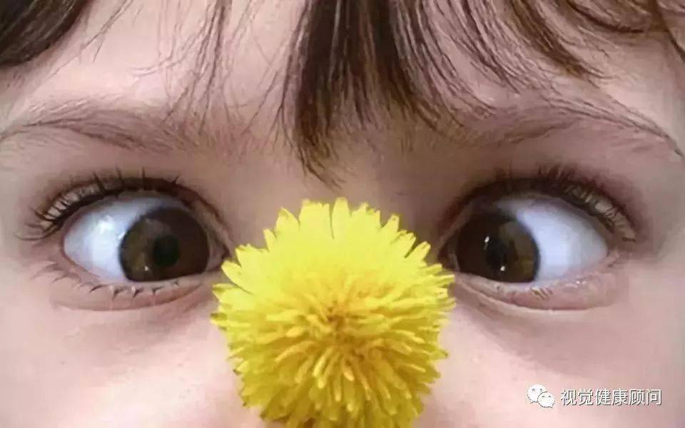 近视防治指南斜视诊治指南弱视诊治指南