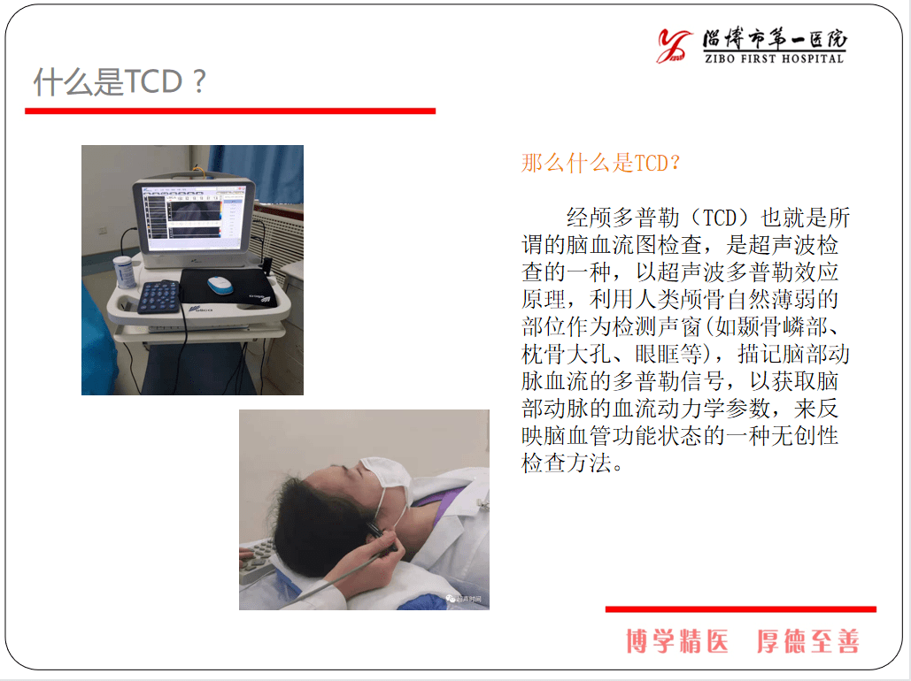 健康体检科普周什么是tcd经颅多普勒