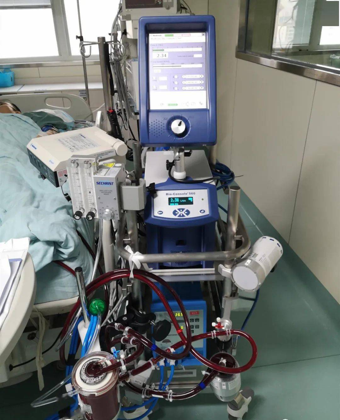 重磅! 我院ecmo救治中心正式成立,并成功完成首例清醒ecmo救治!_患者_