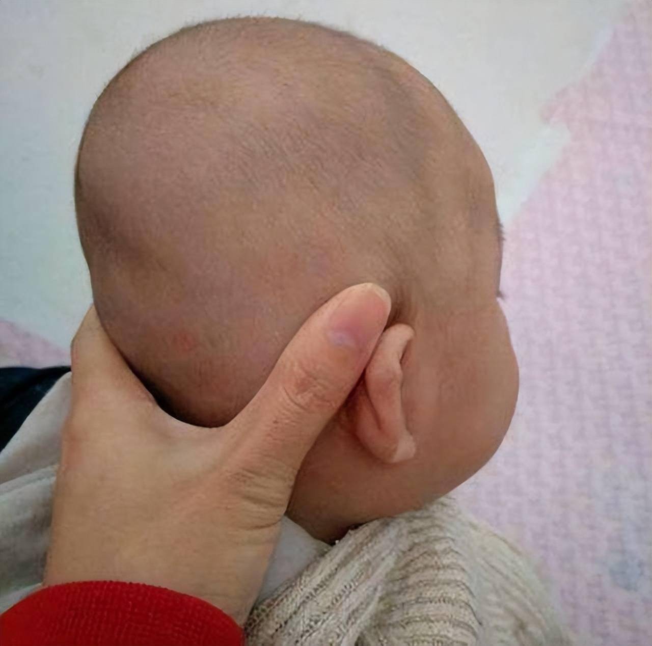 婴儿冠状缝图片