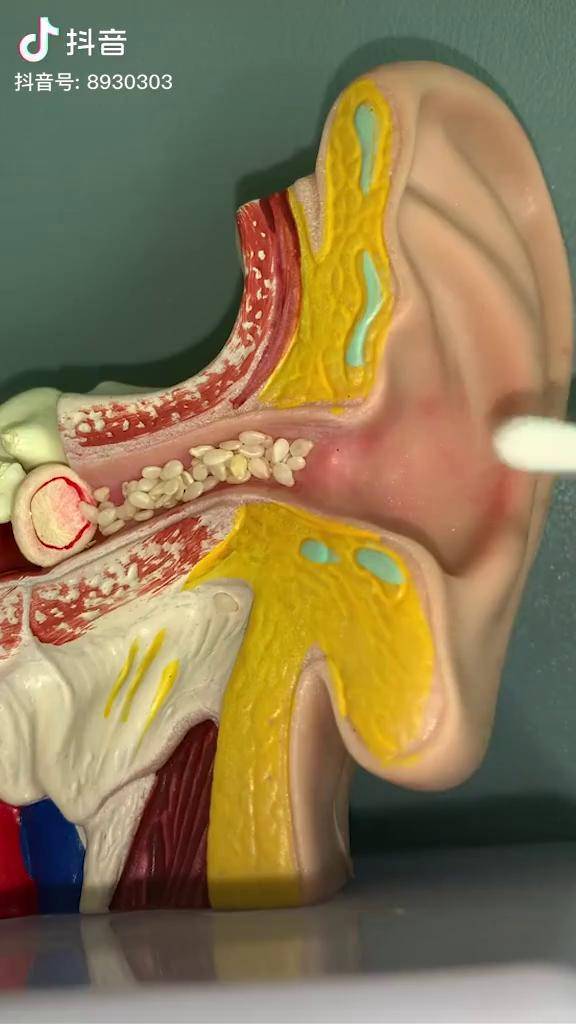 不用这个挖耳勺都不知道耳朵里有多脏好物推荐挖耳勺六件套