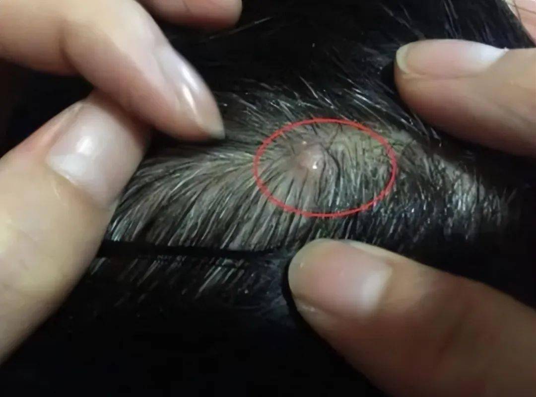 洗头_头发_问题