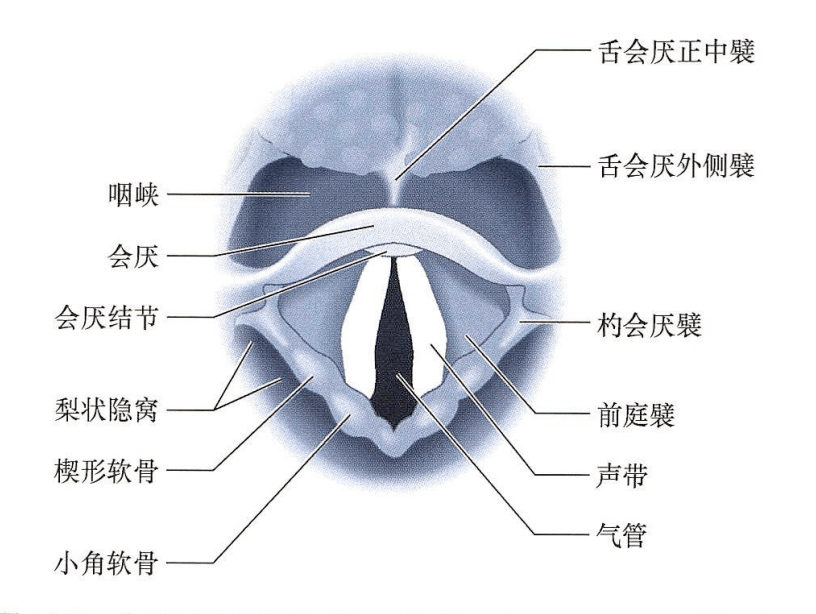 环杓关节脱位一定是气管插管的罪吗