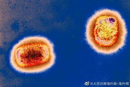 猴痘会成为另一场大流行病吗