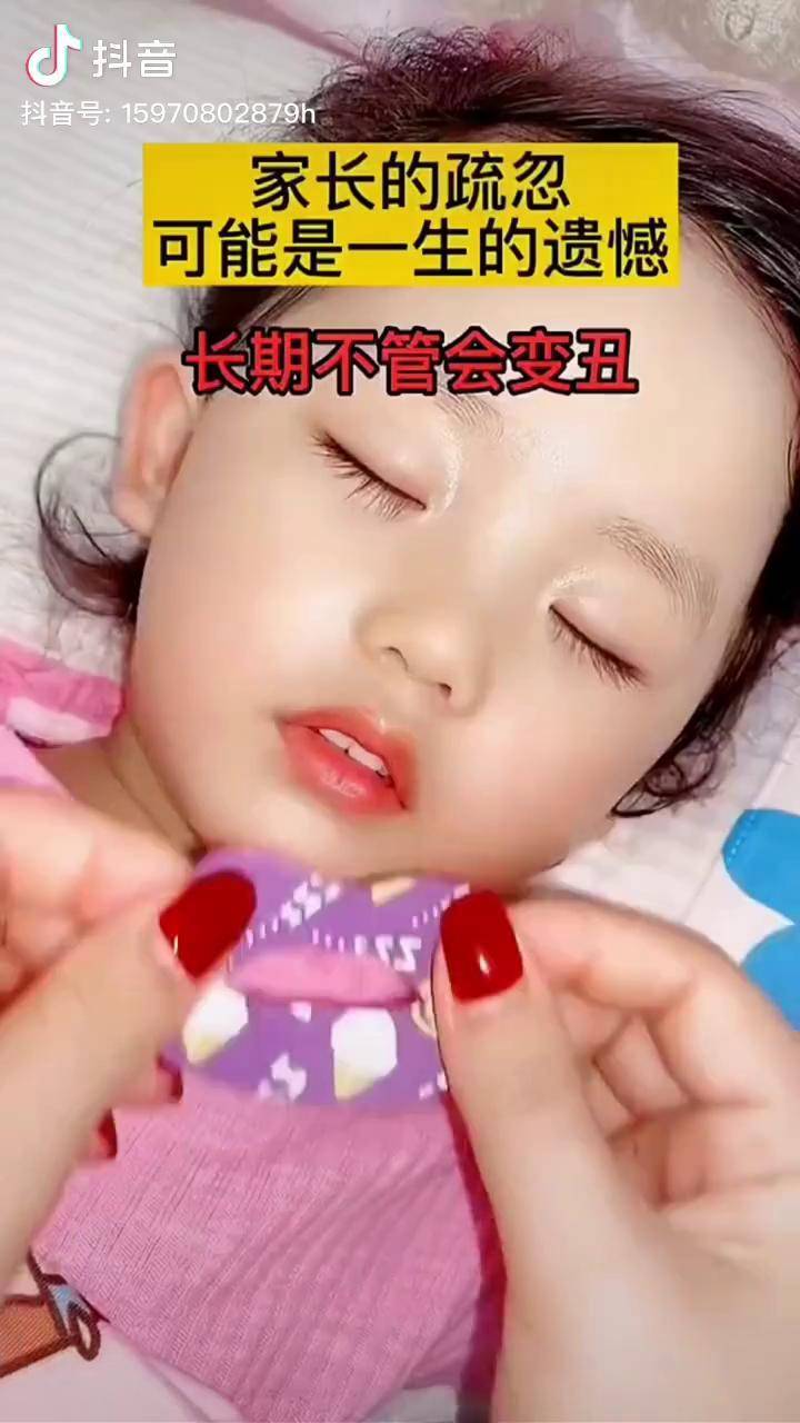 孩子张嘴睡觉要及时纠正久了会变丑的哦等嘴凸了就不好看了有了它就不