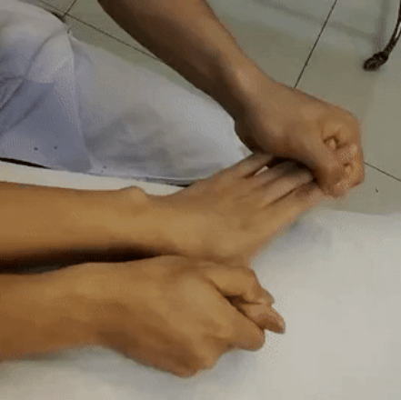 手功能基地系列微文68脑卒中上肢运动分析与康复