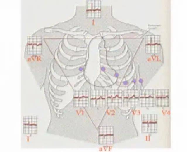 心內科比較特殊,有時會需要做18導聯,這裡先不詳細贅述,詳細內容v6:在