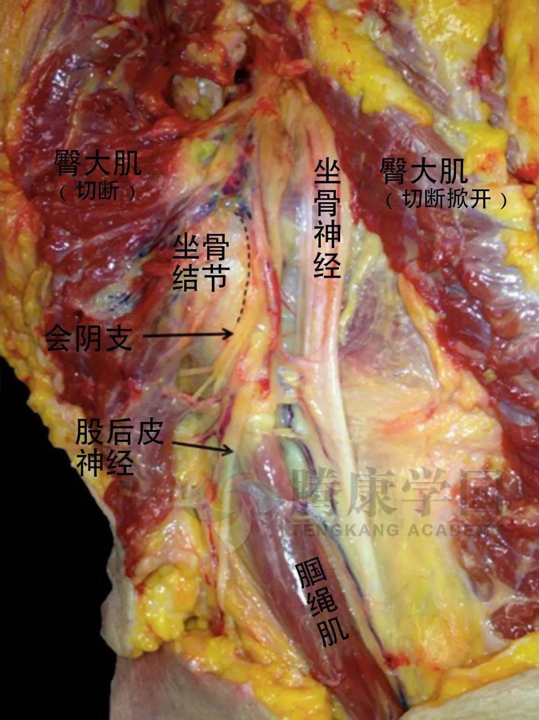 大腿后部疼痛的神经