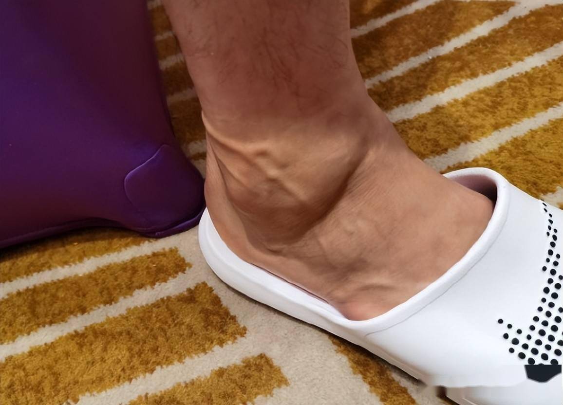 心疼!郭艾伦膝盖 脚踝伤势官宣,仍有肿胀,又要带伤征战了