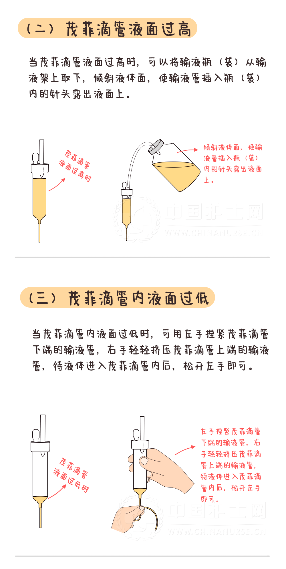 一次性输液器毁型图解图片