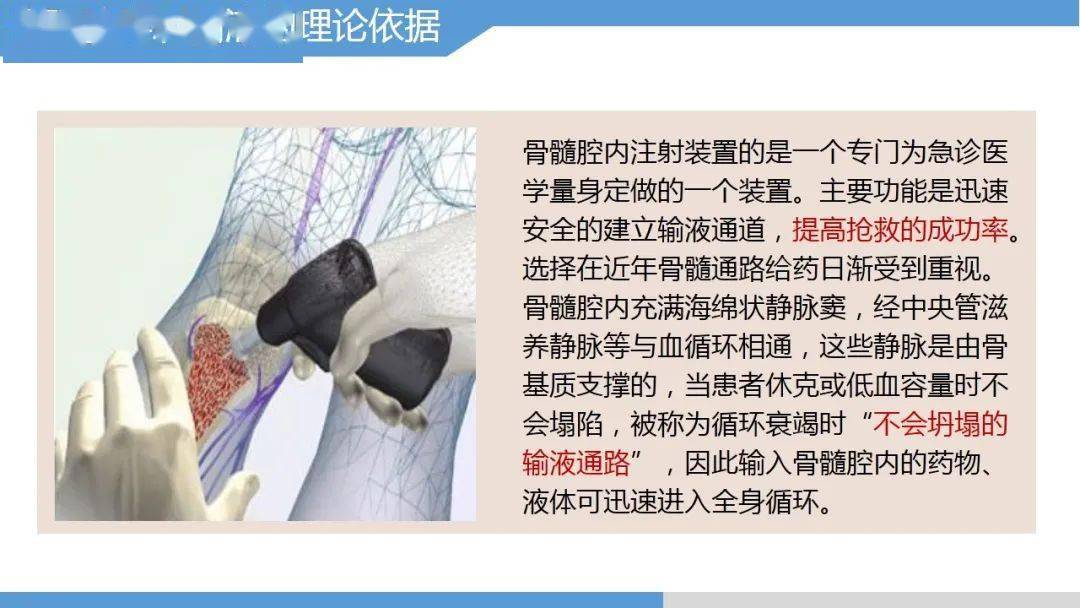 【ppt】永不塌陷的生命通路-骨髓腔输液技术_护理_微信_中卫