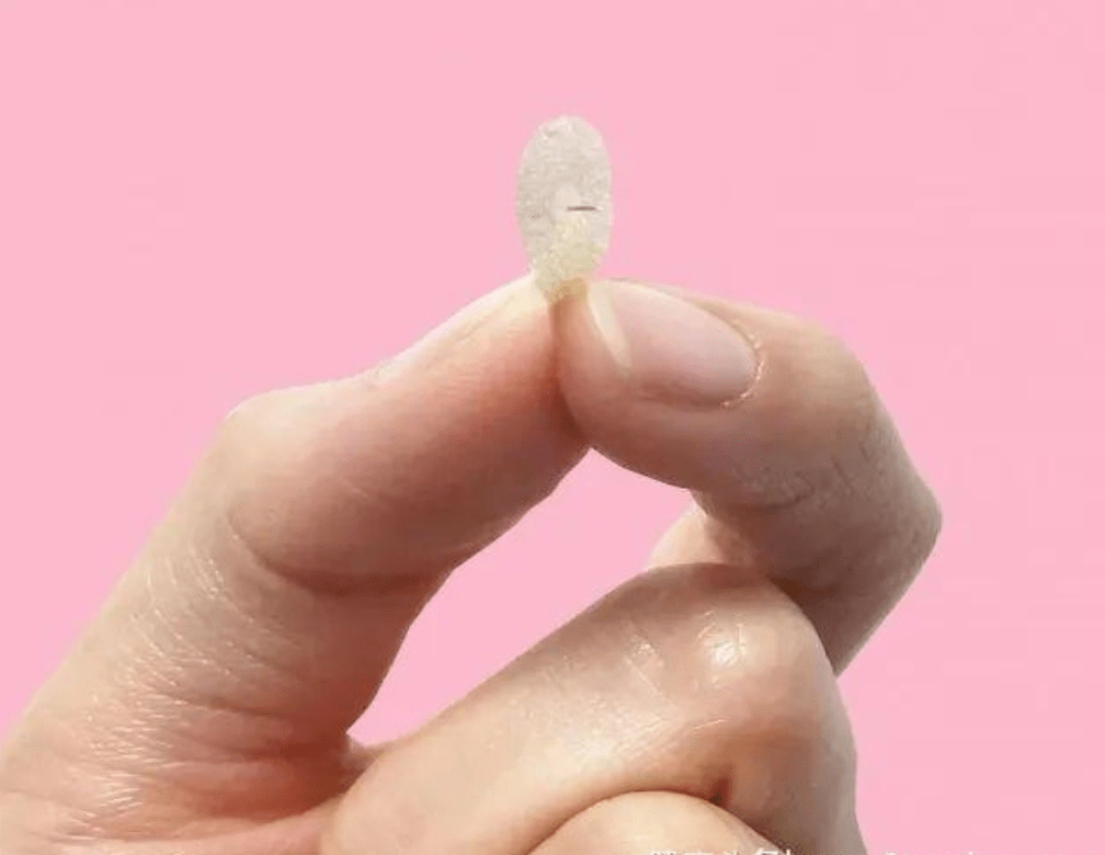 人大评议专区针爱健康带您看看什么是揿针疗法