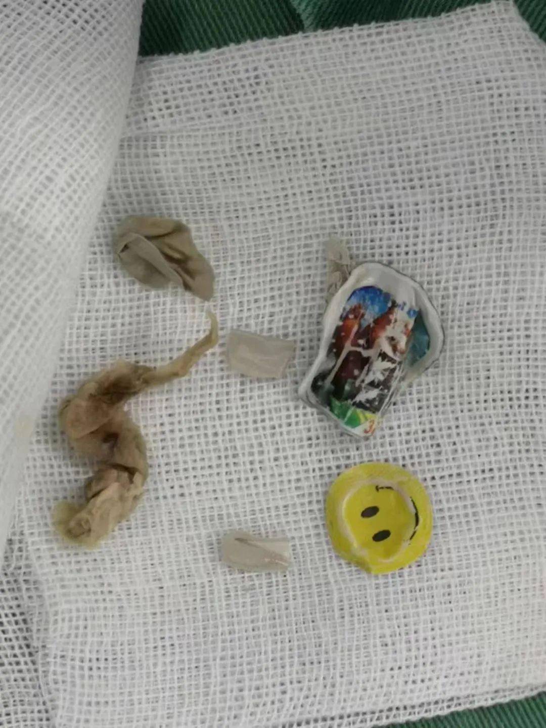 惊心女童阴道发现异物医生提醒家长要注意