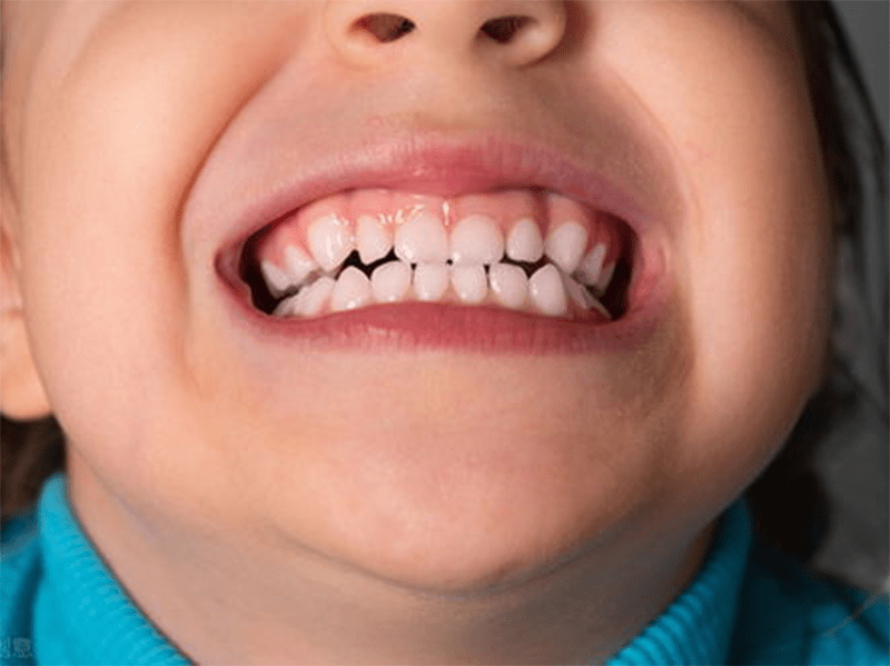 儿童换牙时间和顺序图(孩子换牙是什么时候)