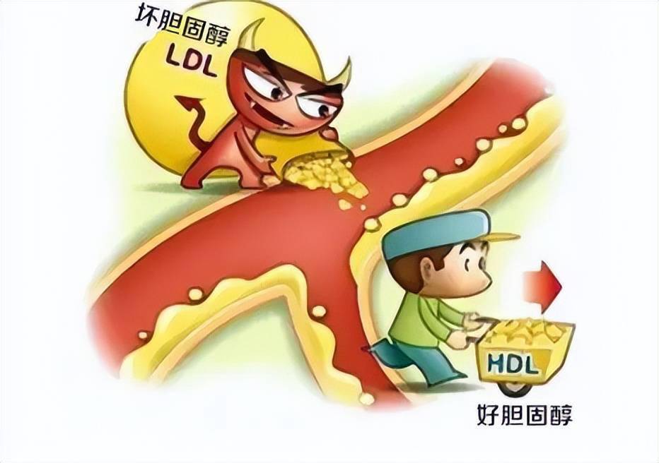 胆固醇_因素_药物