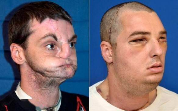 俄勒冈州蒙诺玛郡一名吸毒的女子在7年间的变化,好端端的一个人沾染上