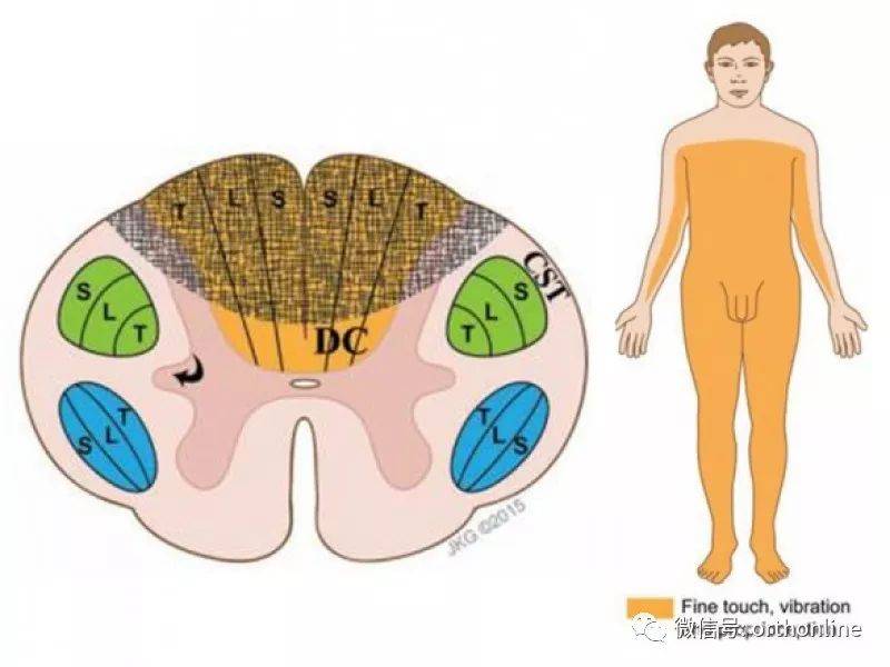 一文讀懂脊髓的解剖和定位診斷