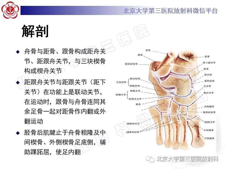 成人足舟骨坏死_平台_解剖_髌骨