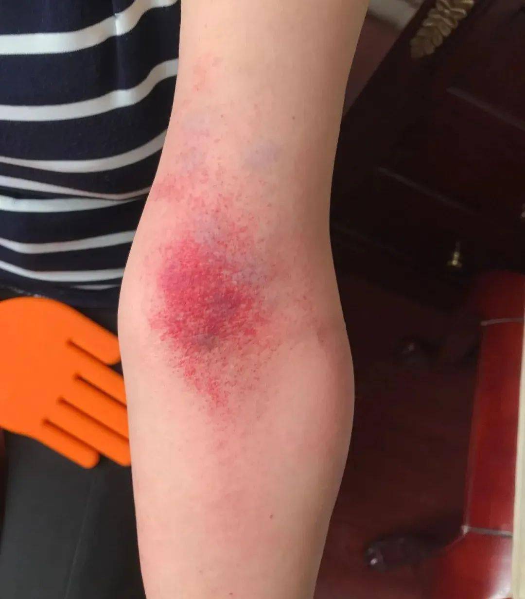 女性嘴唇腹股沟颜色越深说明血液子宫越脏