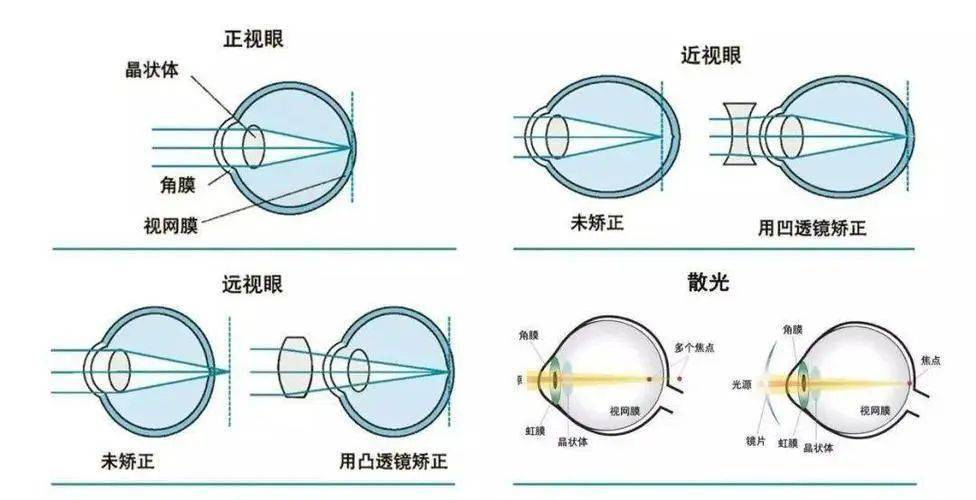 眼的屈光系统_晶状体_视网膜_人眼