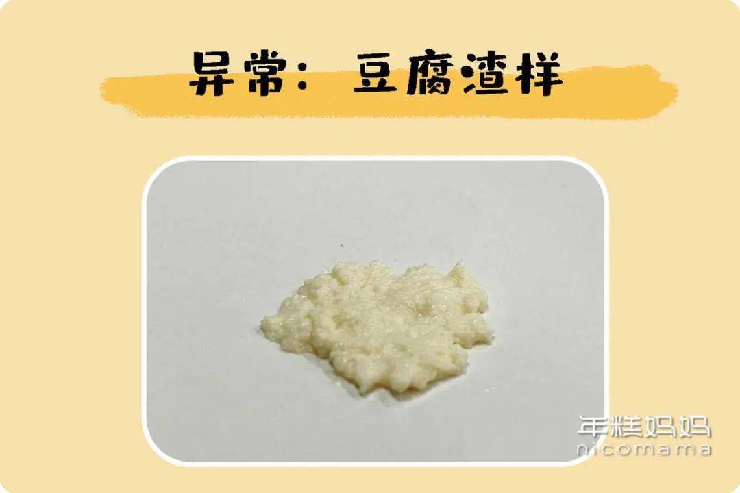 分泌物豆腐渣样图片