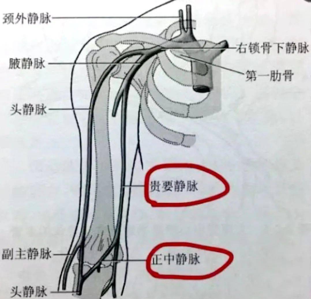 picc置管血管走向图图片